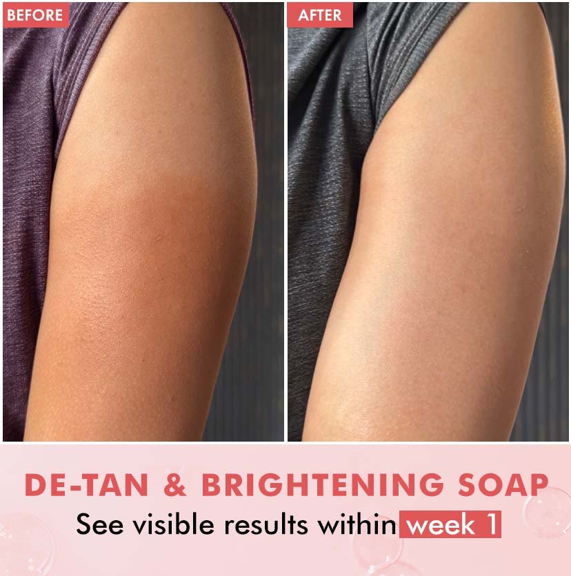 mCaffeine Brightening Tan Removal 1% Kojic Acid & Glutathione Guava Fizz Soap - 300g (3x100g)